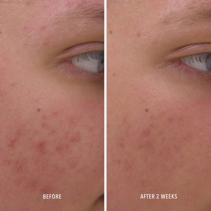 CLEAR RESCUE - Skin-Refining Serum