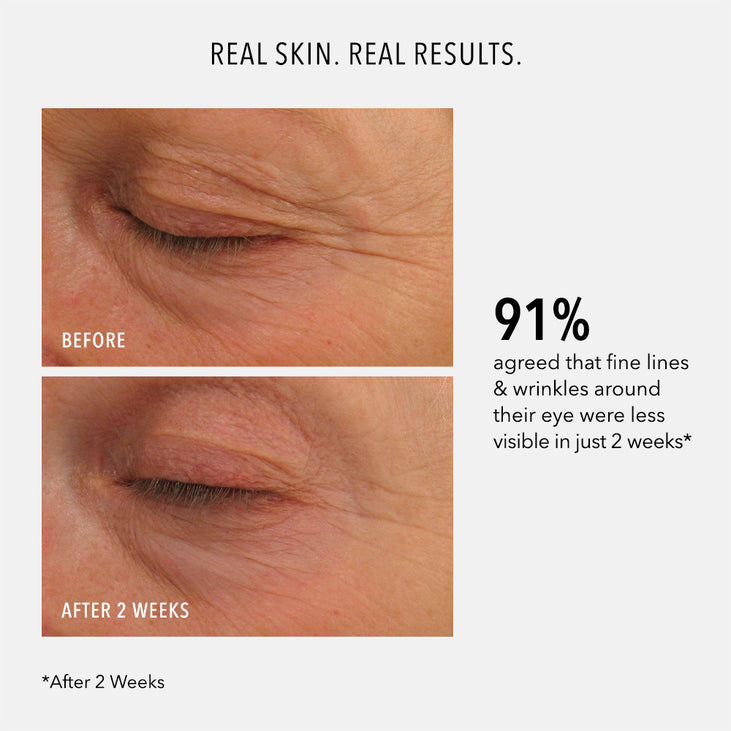 EYE AUTHORITY - Dark Circles, Puffiness, Fine Lines