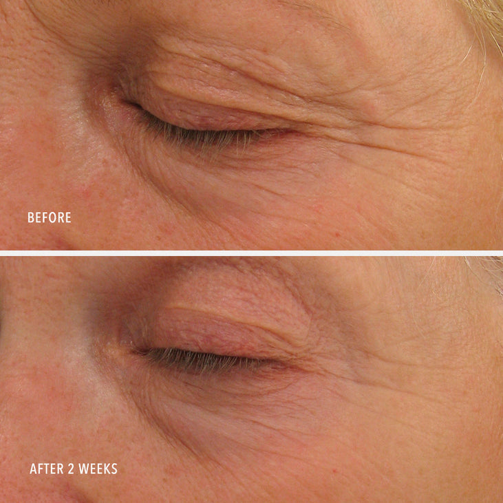 EYE AUTHORITY - Dark Circles, Puffiness, Fine Lines