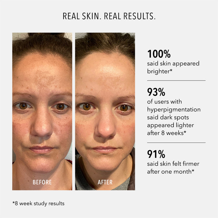 FIRMA-BRIGHT - 20% Vitamin C Booster