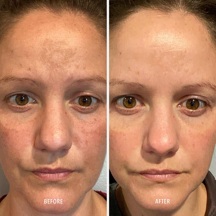 FIRMA-BRIGHT - 20% Vitamin C Booster