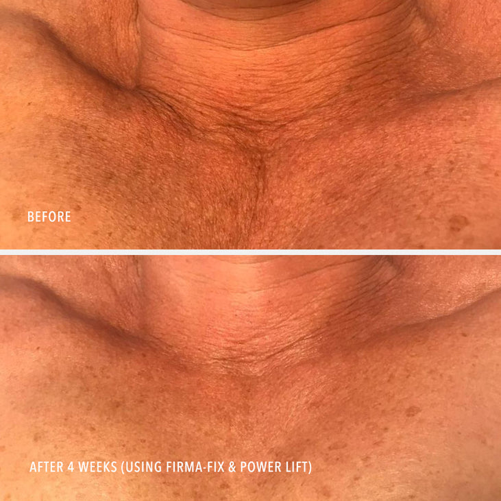 FIRMA-FIX NECTAR - Lifting Neck & Décolleté Serum