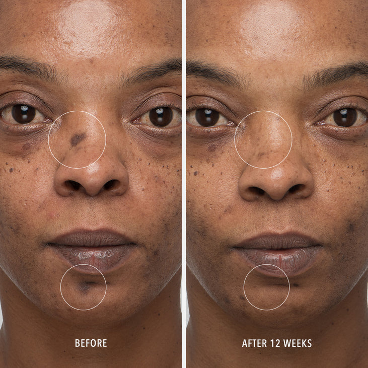 INNERDERM RX - Daily Skin Health Supplement