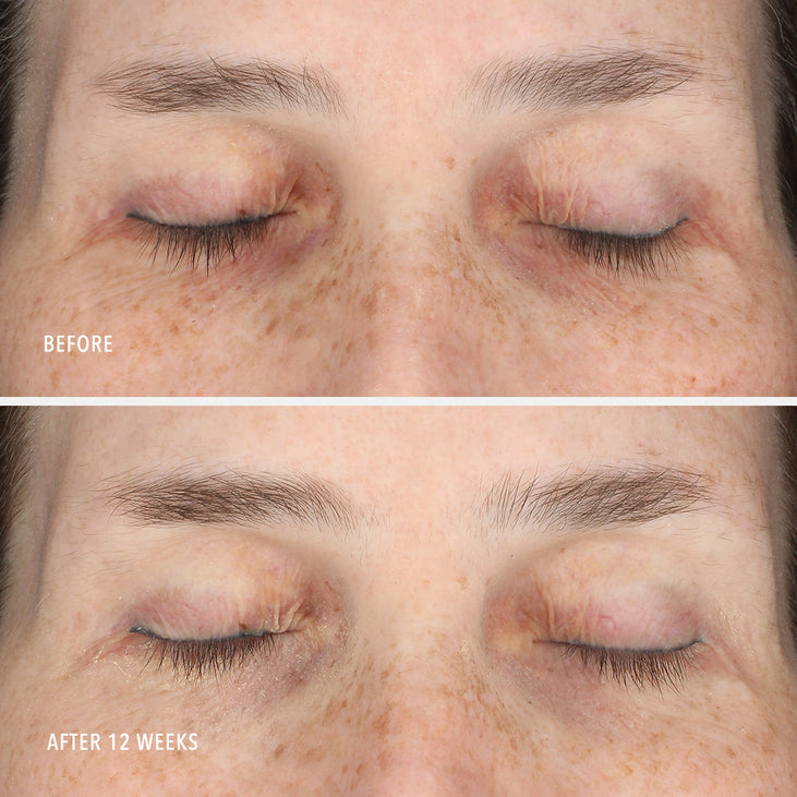 INNERDERM RX PLUS - Daily Skin Health Supplement