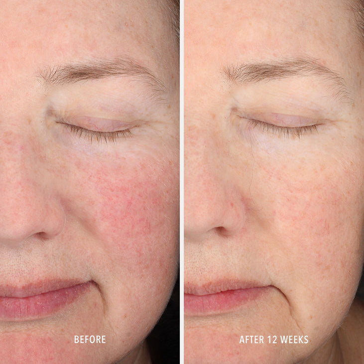 INNERDERM RX - Daily Skin Health Supplement