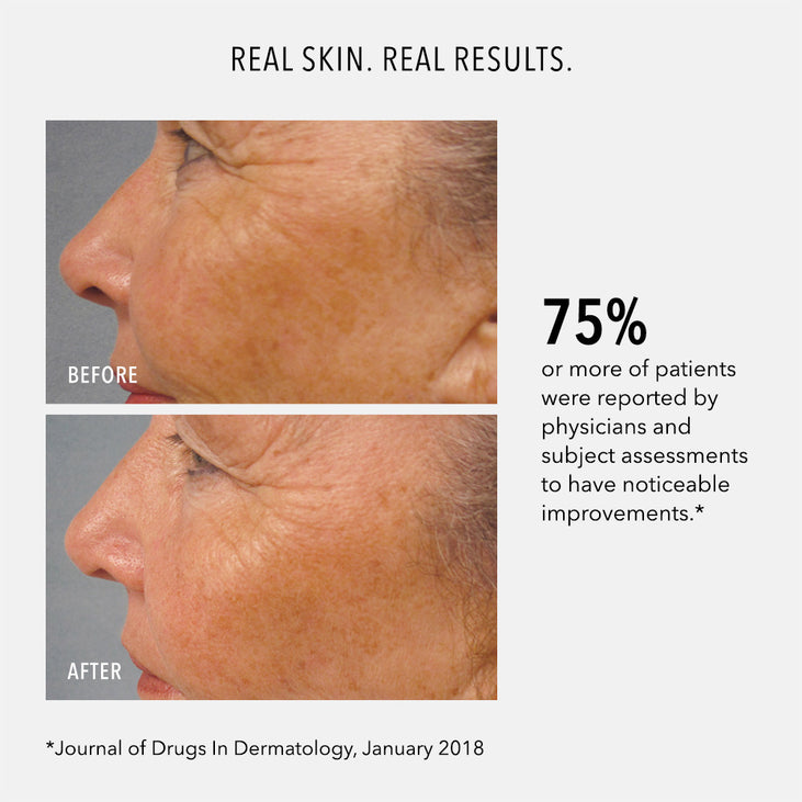 LUMAPRO-C SERUM - Skin Brightening Pigment Corrector