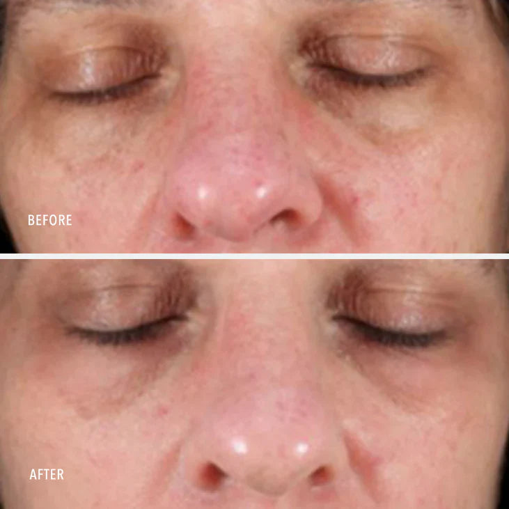 NIMNI DAY CREAM - Patented Collagen Support Complex