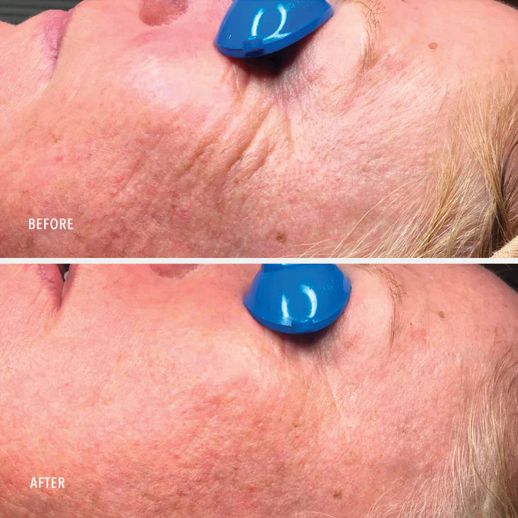 NIMNI DAY CREAM - Patented Collagen Support Complex