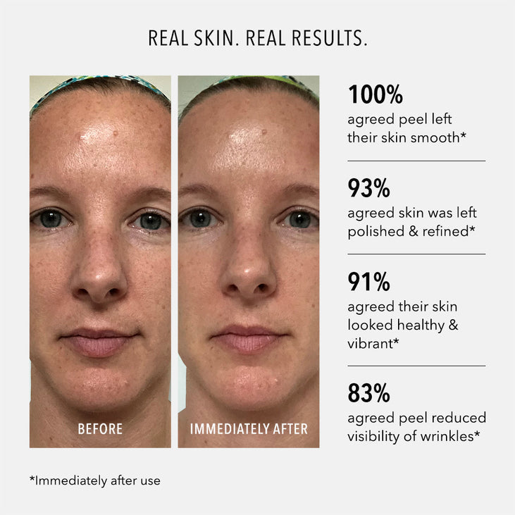 POLISH & PLUMP FACE PEEL - 2 Step System