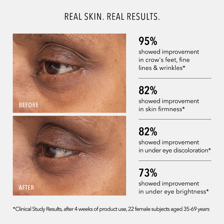 RETINOL EYE RENEWAL - Lifting & Firming Eye Balm