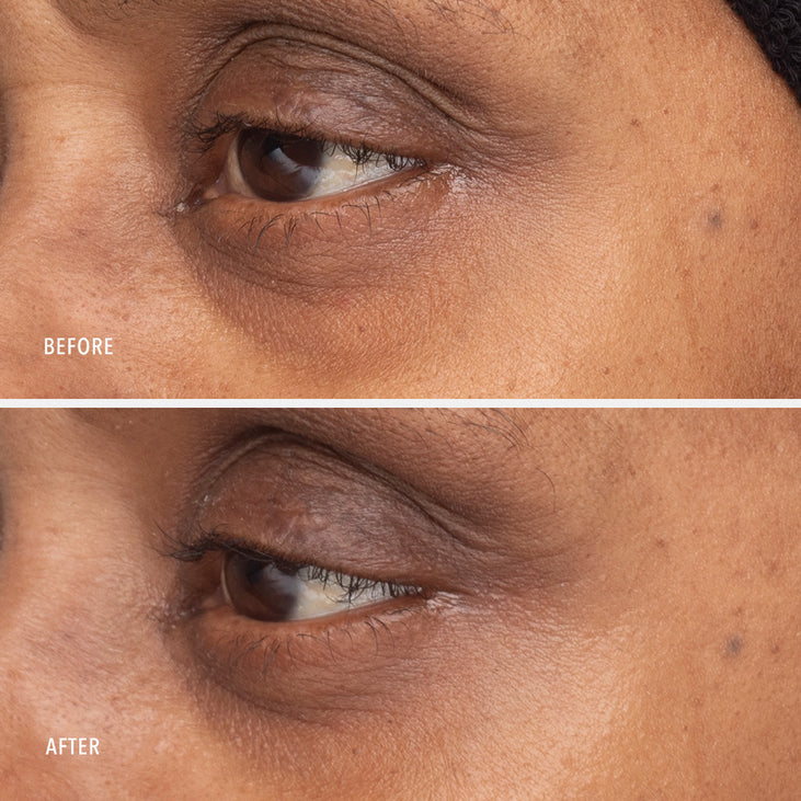 RETINOL EYE RENEWAL - Lifting & Firming Eye Balm