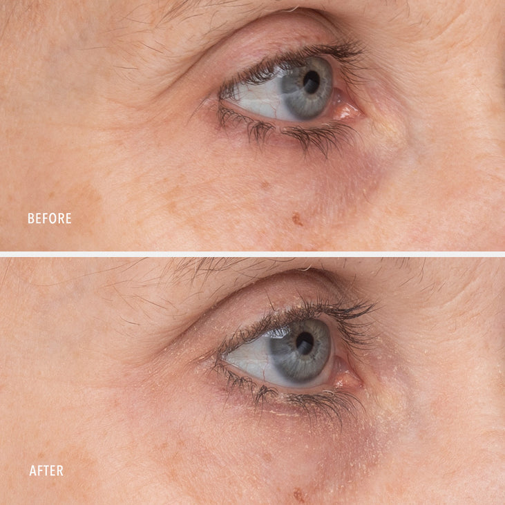 RETINOL EYE RENEWAL - Lifting & Firming Eye Balm