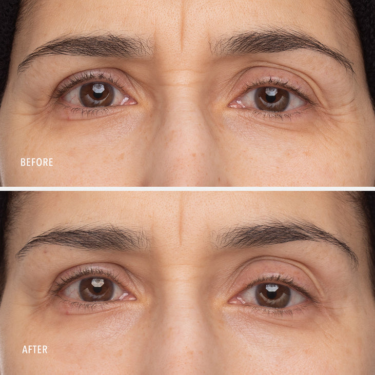 RETINOL EYE RENEWAL - Lifting & Firming Eye Balm