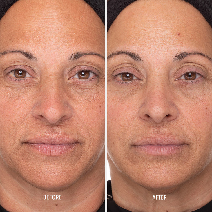 RETINOL ROUTINE BOOSTER - 1% Retinol Solution