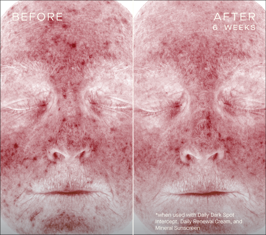 Daily Dark Spot Intercept