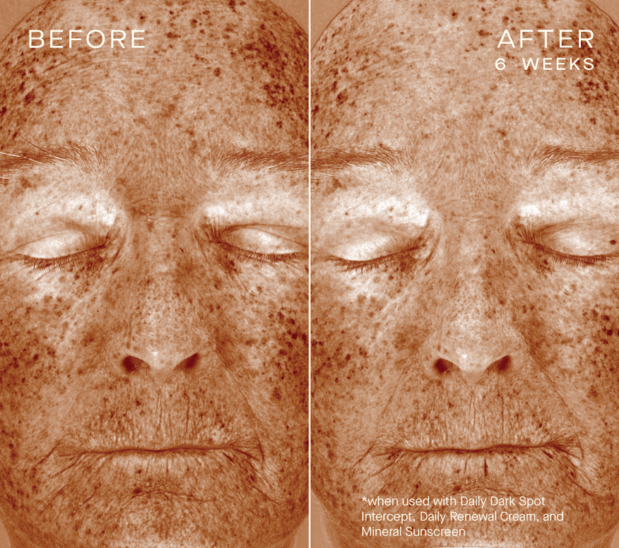 Daily Dark Spot Intercept