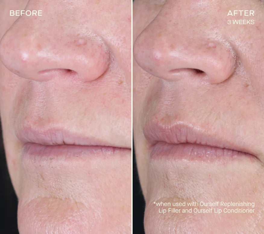 Replenishing Lip Filler Refill