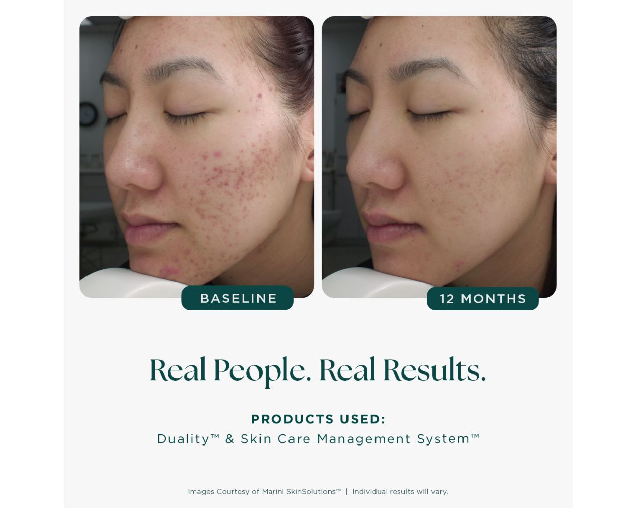 Duality™ - 1 fl. oz.