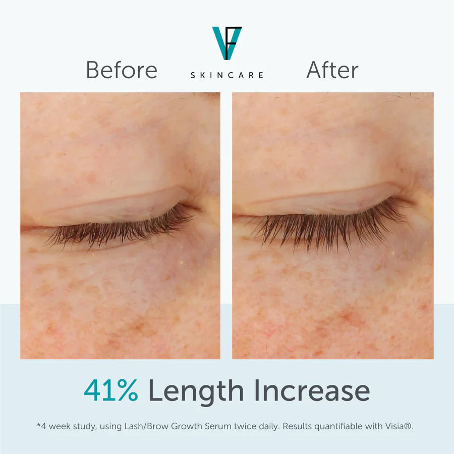 Lash/Brow Growth Serum