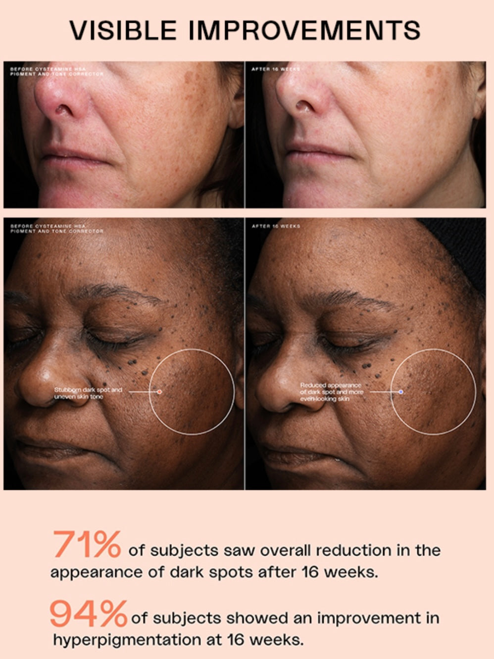 Sente HSA Pigment & Tone Corrector