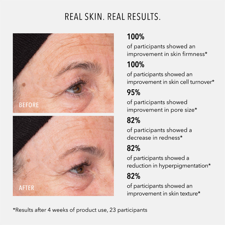 LIQUID RESURFACING SOLUTION - Daily Leave-On Exfoliant