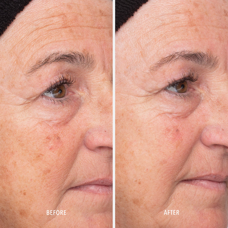 LIQUID RESURFACING SOLUTION - Daily Leave-On Exfoliant