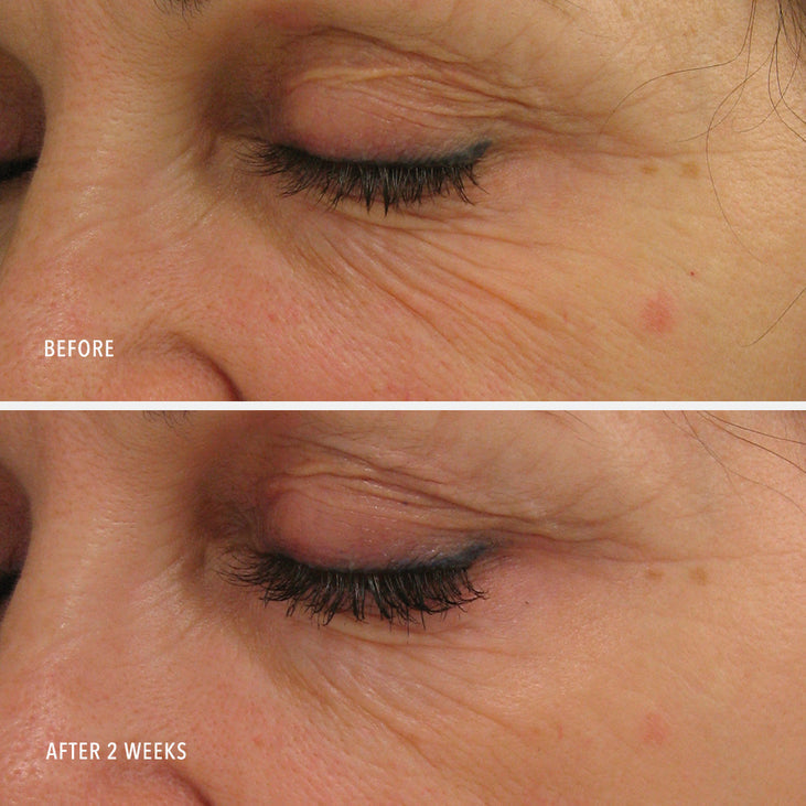 POWER LIFT - Advanced Ultra-Rich Moisturizer