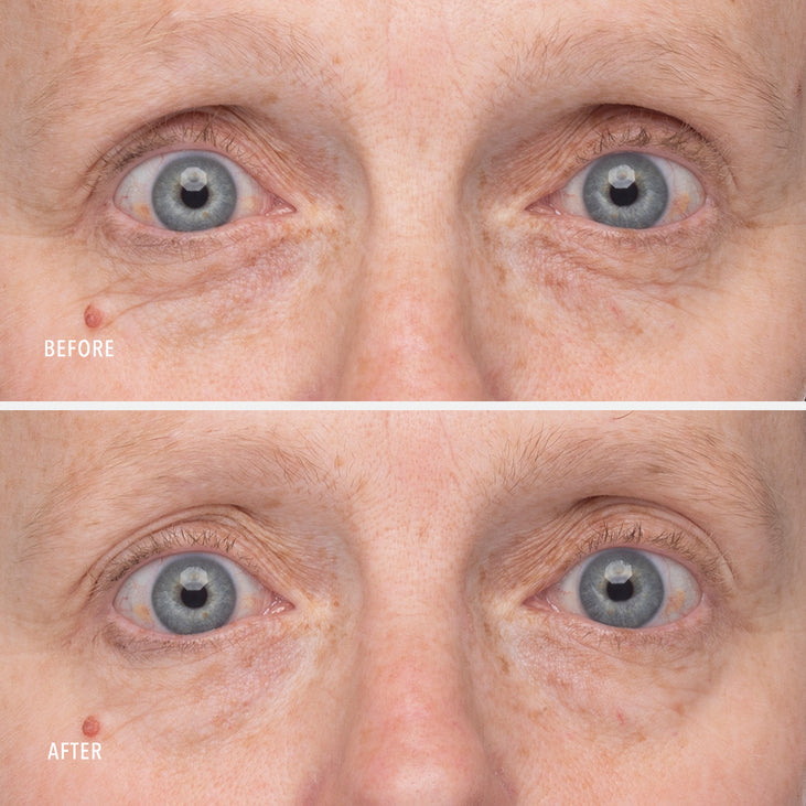RETINOL EYE RENEWAL - Lifting & Firming Eye Balm