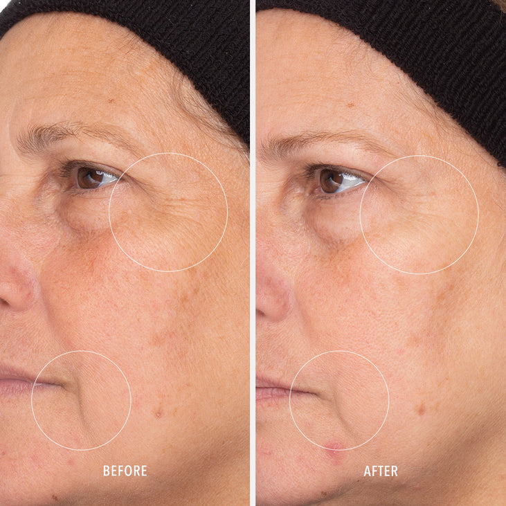 RETINOL ROUTINE BOOSTER - 1% Retinol Solution