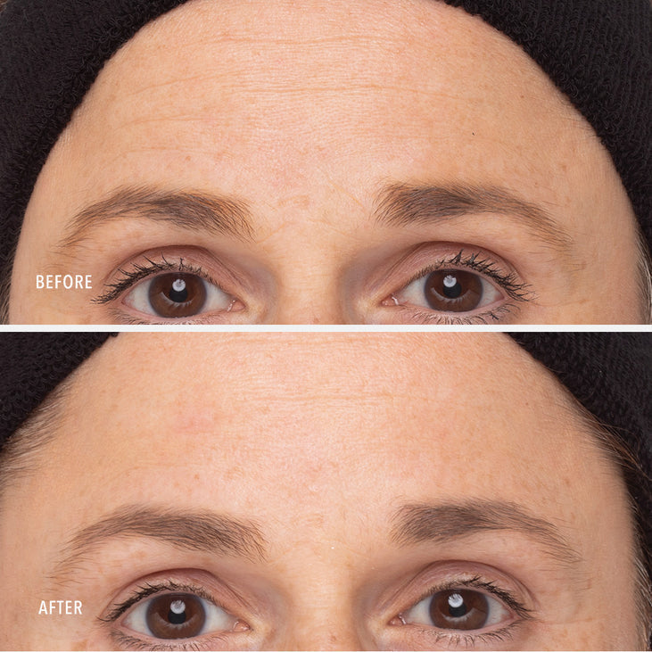RETINOL ROUTINE BOOSTER - 1% Retinol Solution