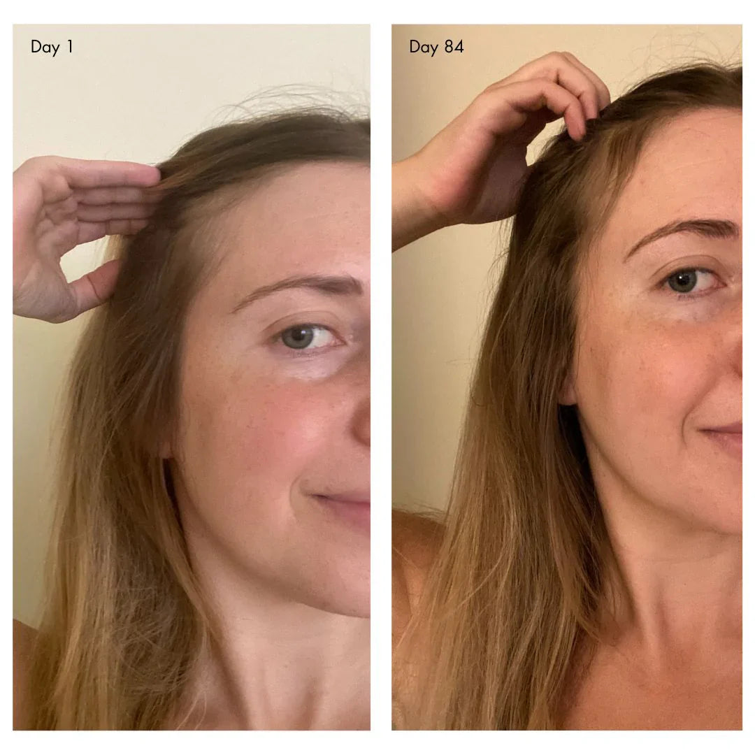 holi (growth) 84 leave-in hair growth scalp spray