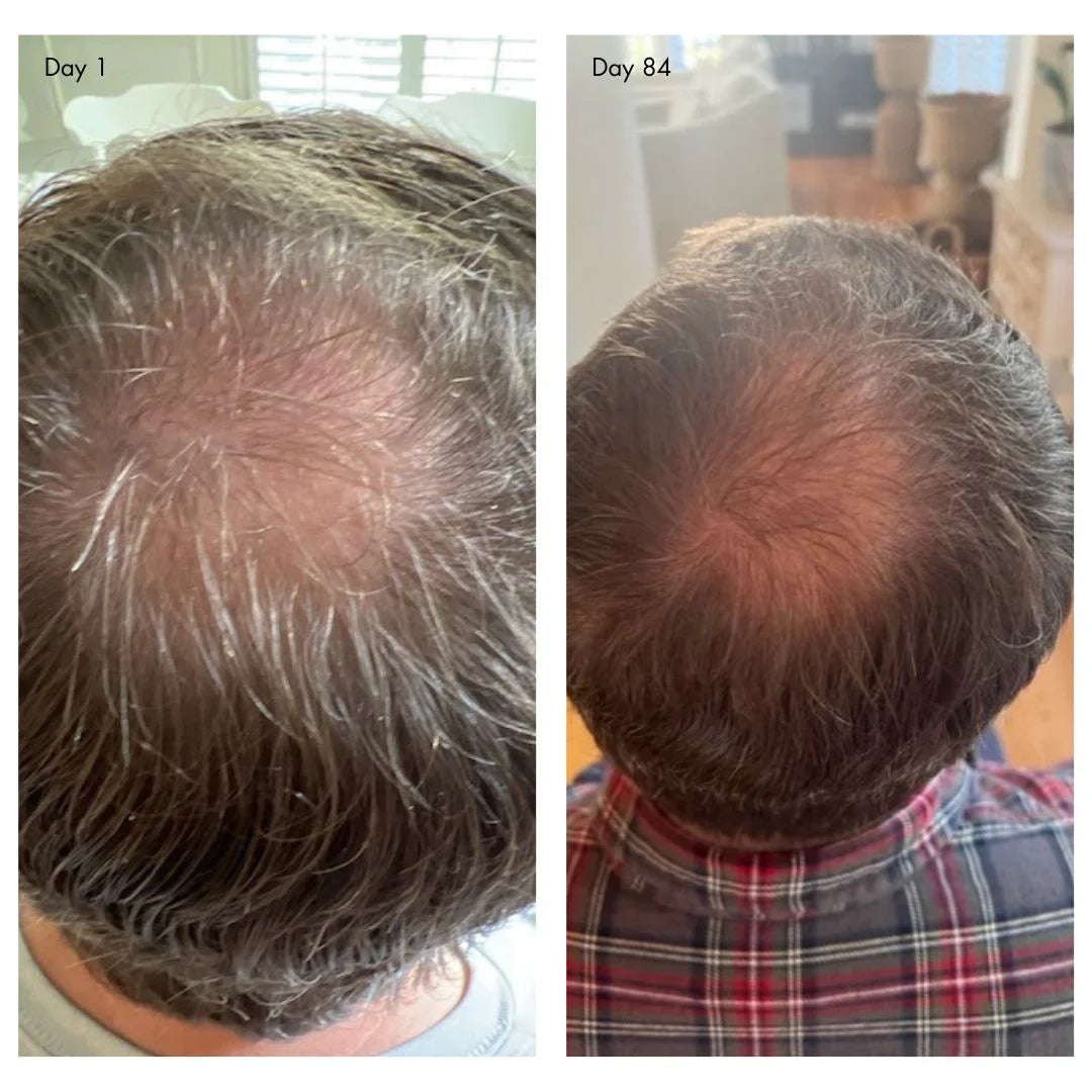 holi (growth) 84 leave-in hair growth scalp spray