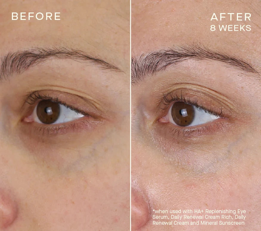 Advanced Regenerative Eye Serum