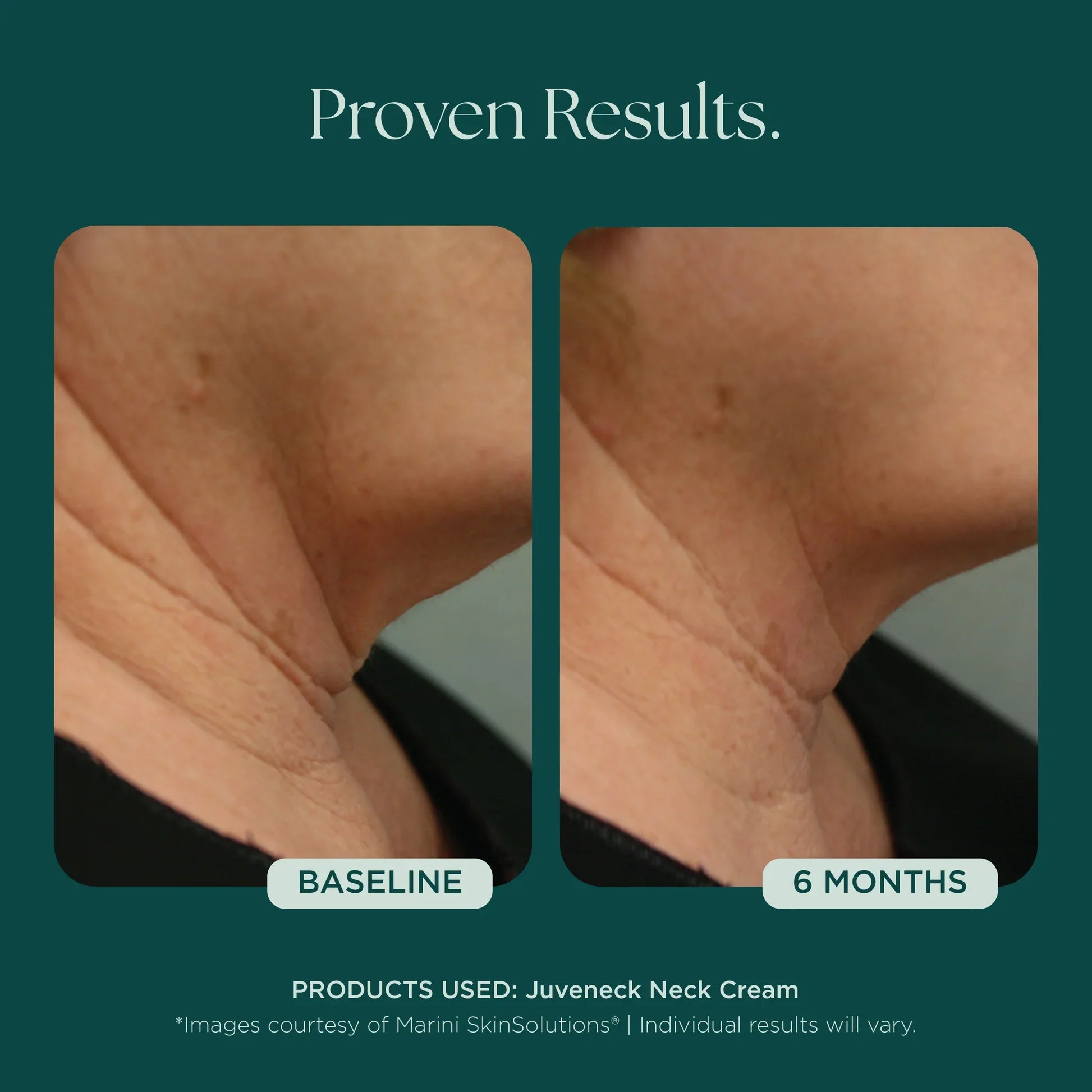 Juveneck Neck Cream