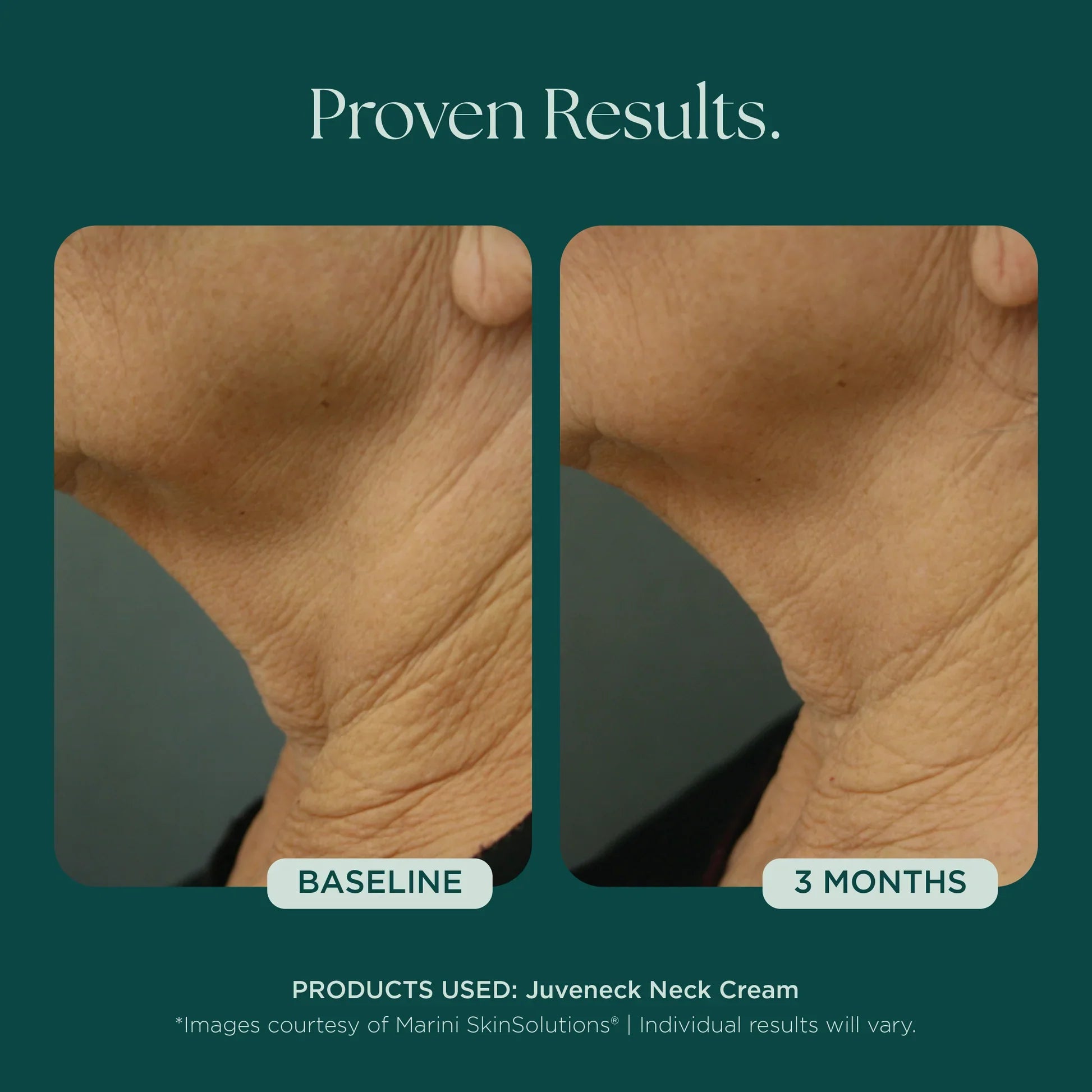 Juveneck Neck Cream