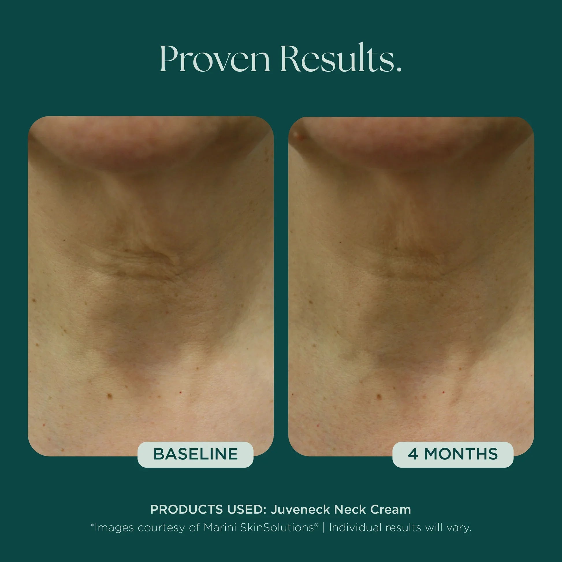 Juveneck Neck Cream