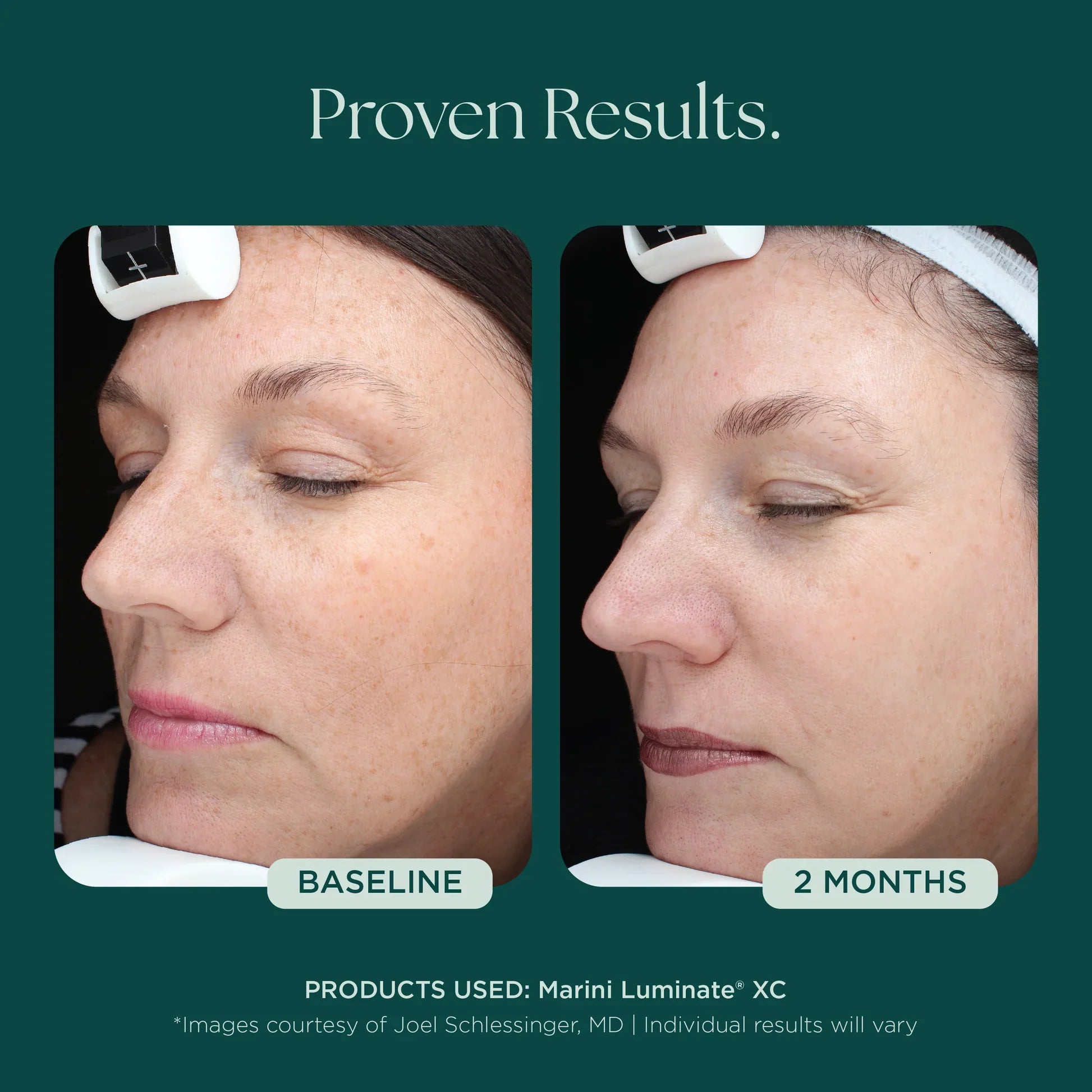 Marini Luminate®
