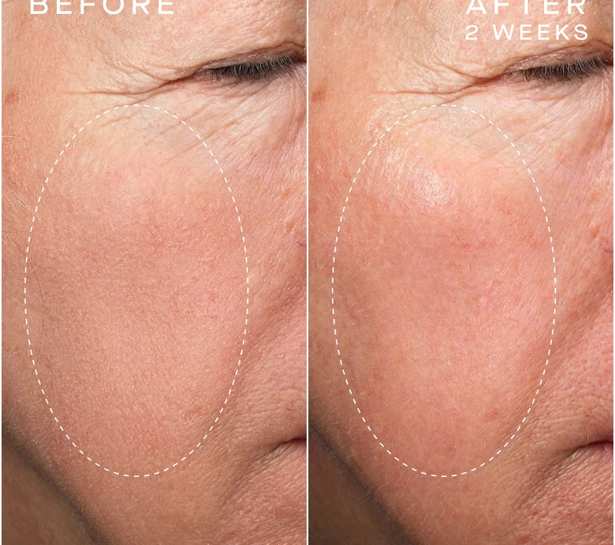 Advanced Regenerative Serum 30mL
