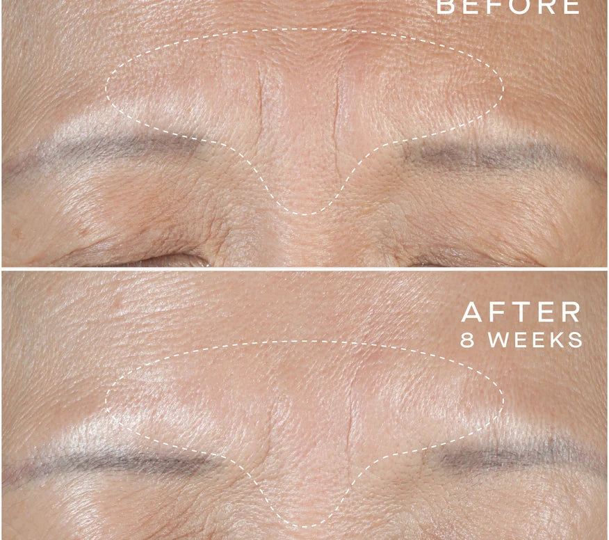 Advanced Regenerative Serum 15mL