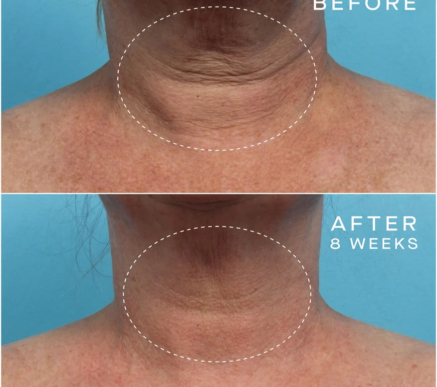 Advanced Regenerative Serum 30mL