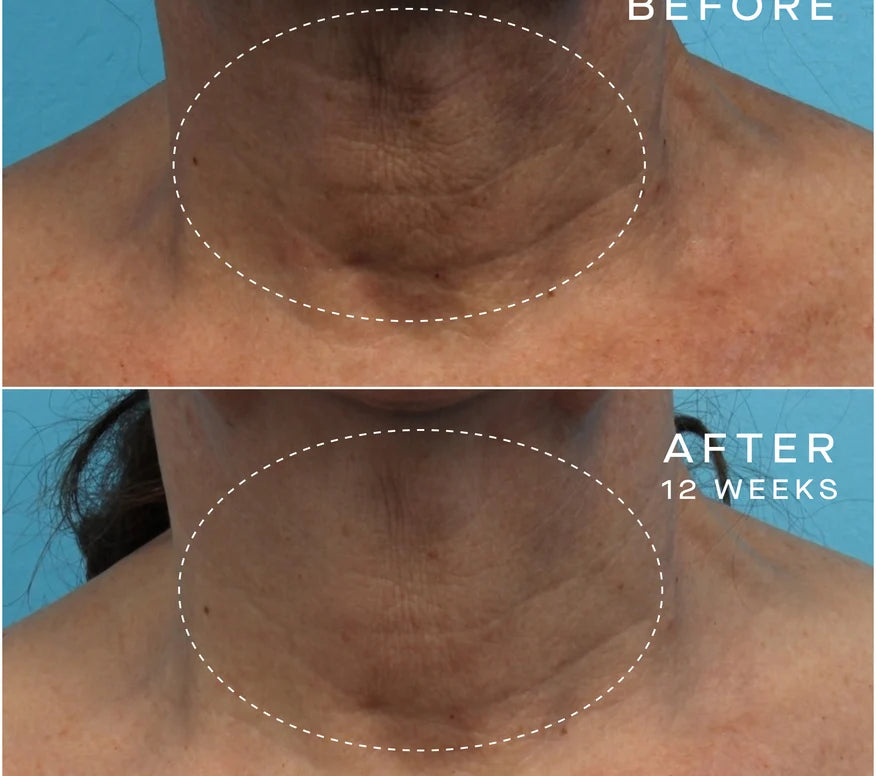 Advanced Regenerative Serum 15mL