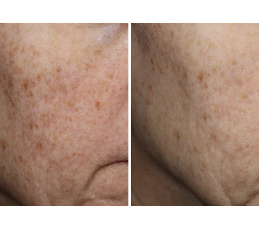 Complexion Brightening Serum