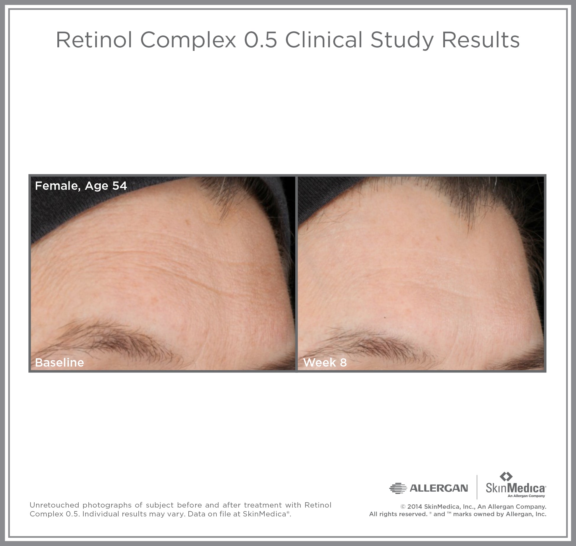 SkinMedica Age Defense Retinol Complex 0.5