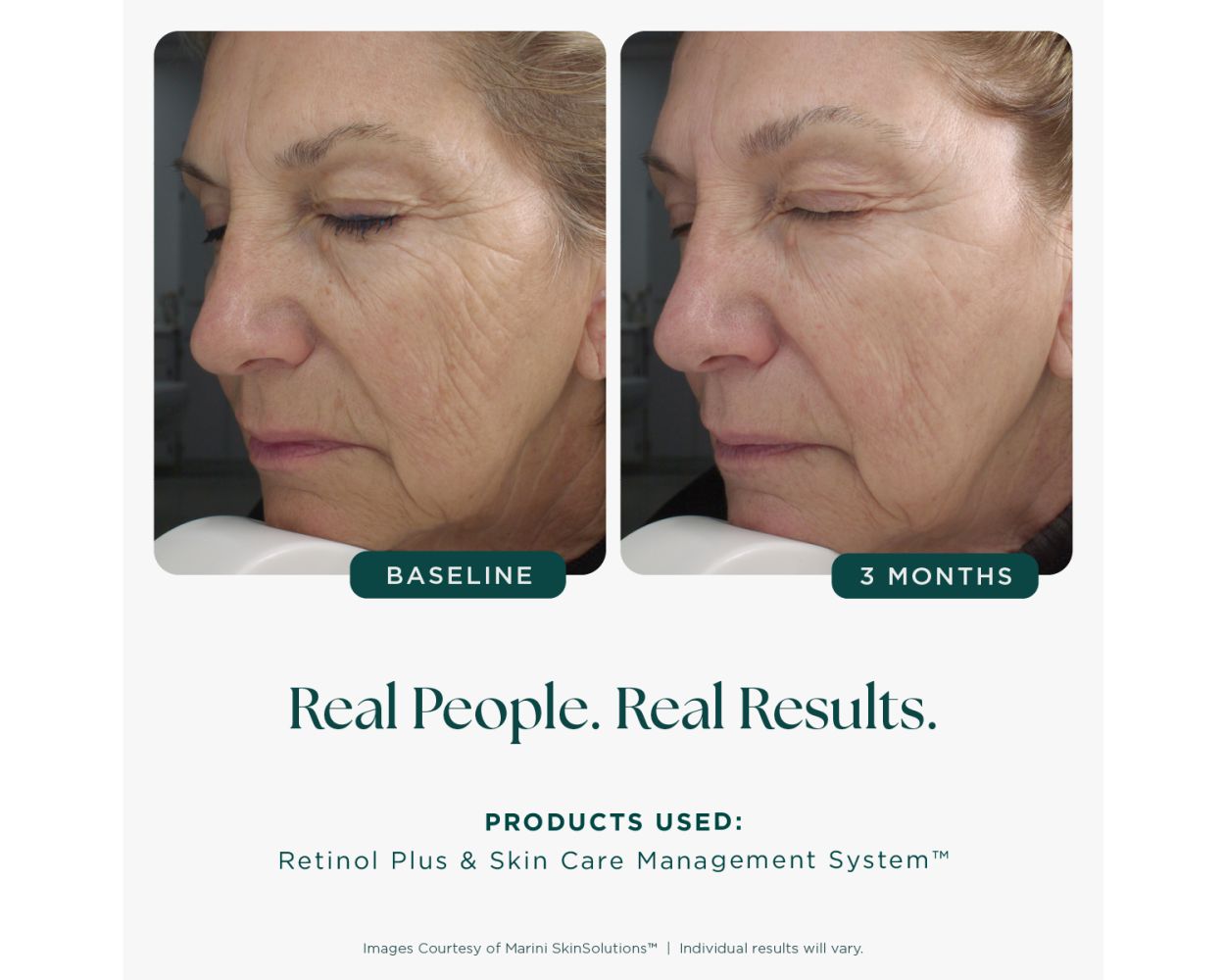 Retinol Plus - 1 fl. oz.