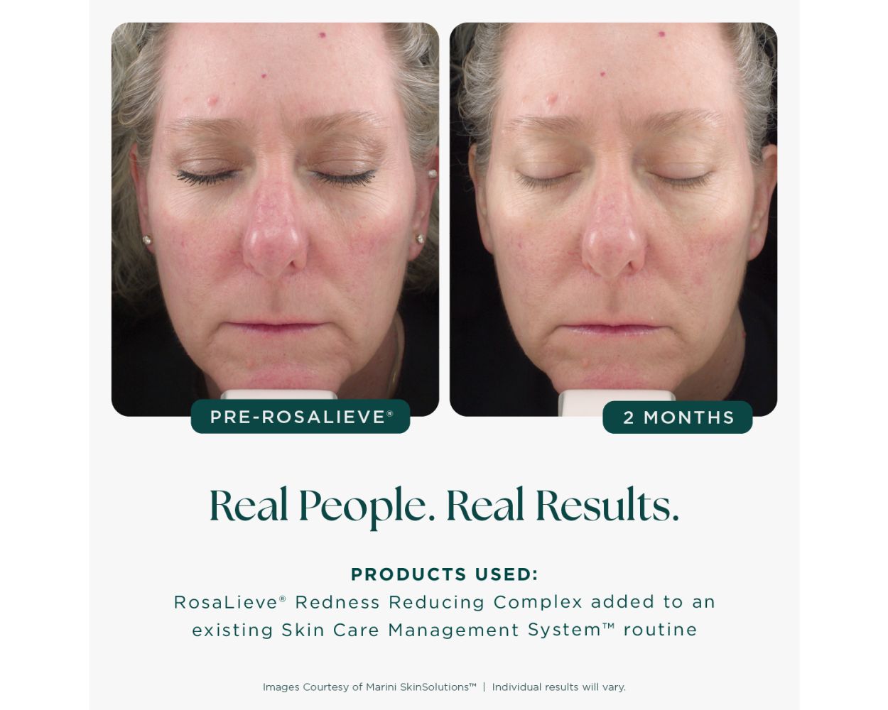 RosaLieve® - 1 fl. oz.