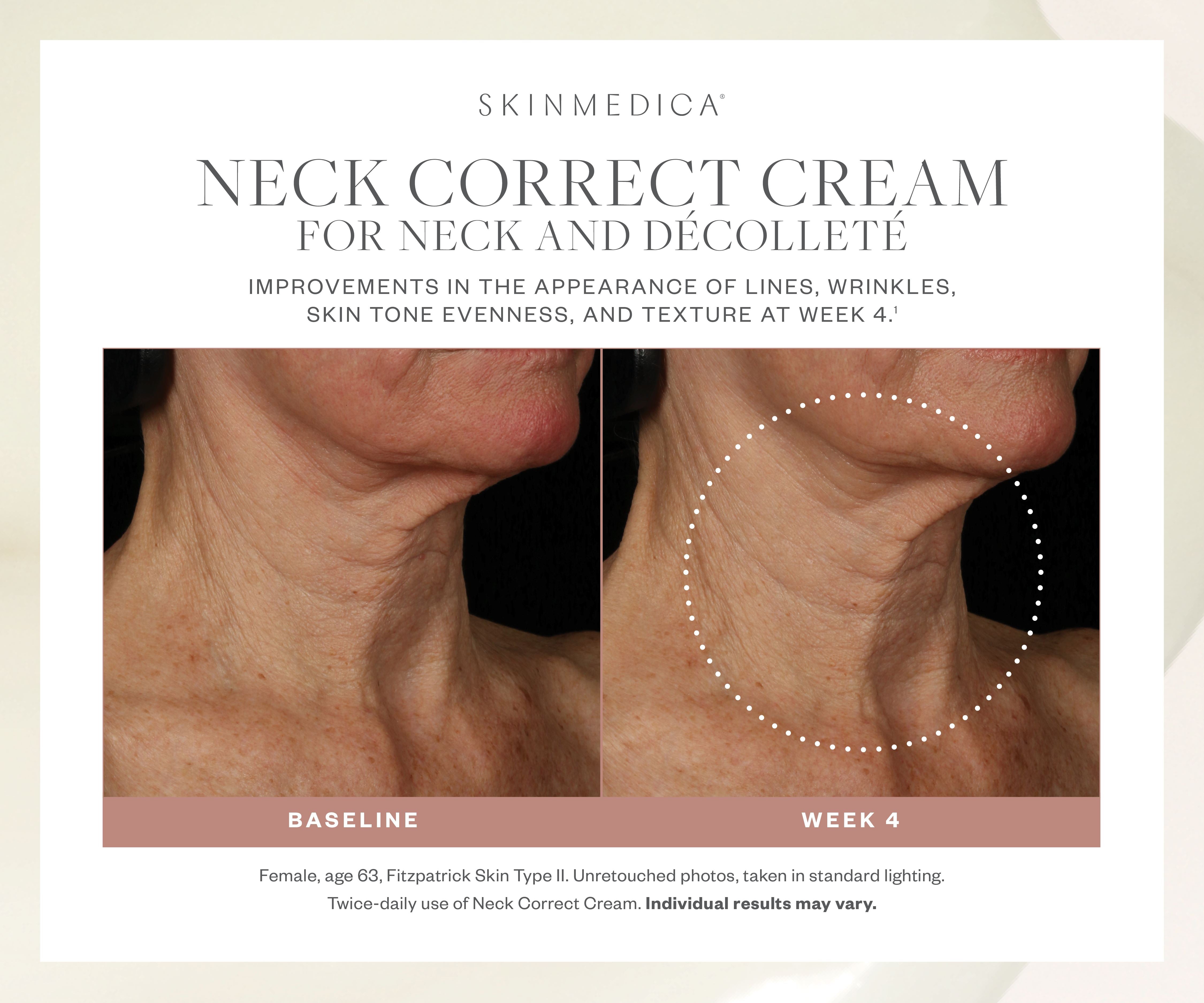 SkinMedica Neck Correct Cream