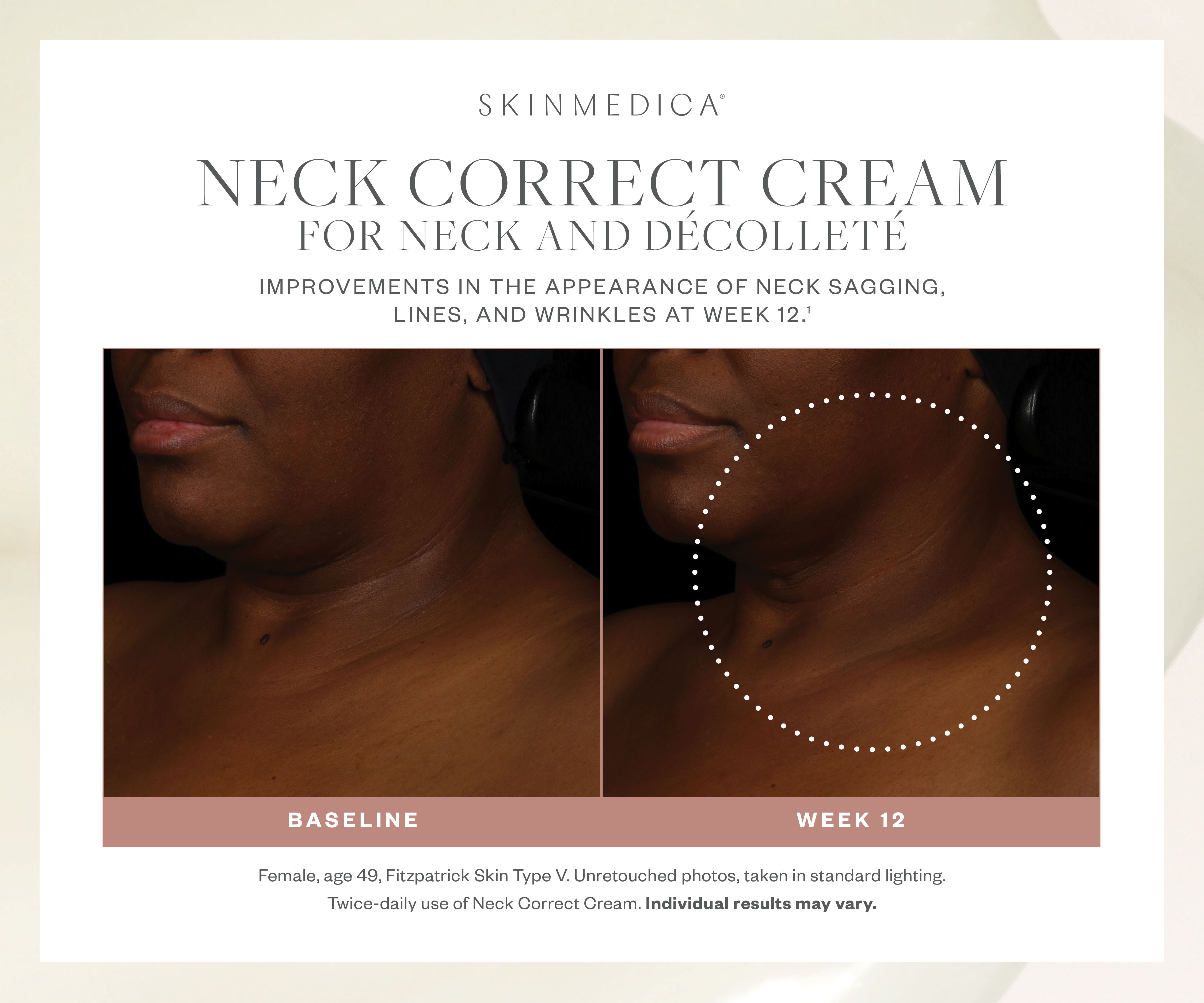 SkinMedica Neck Correct Cream