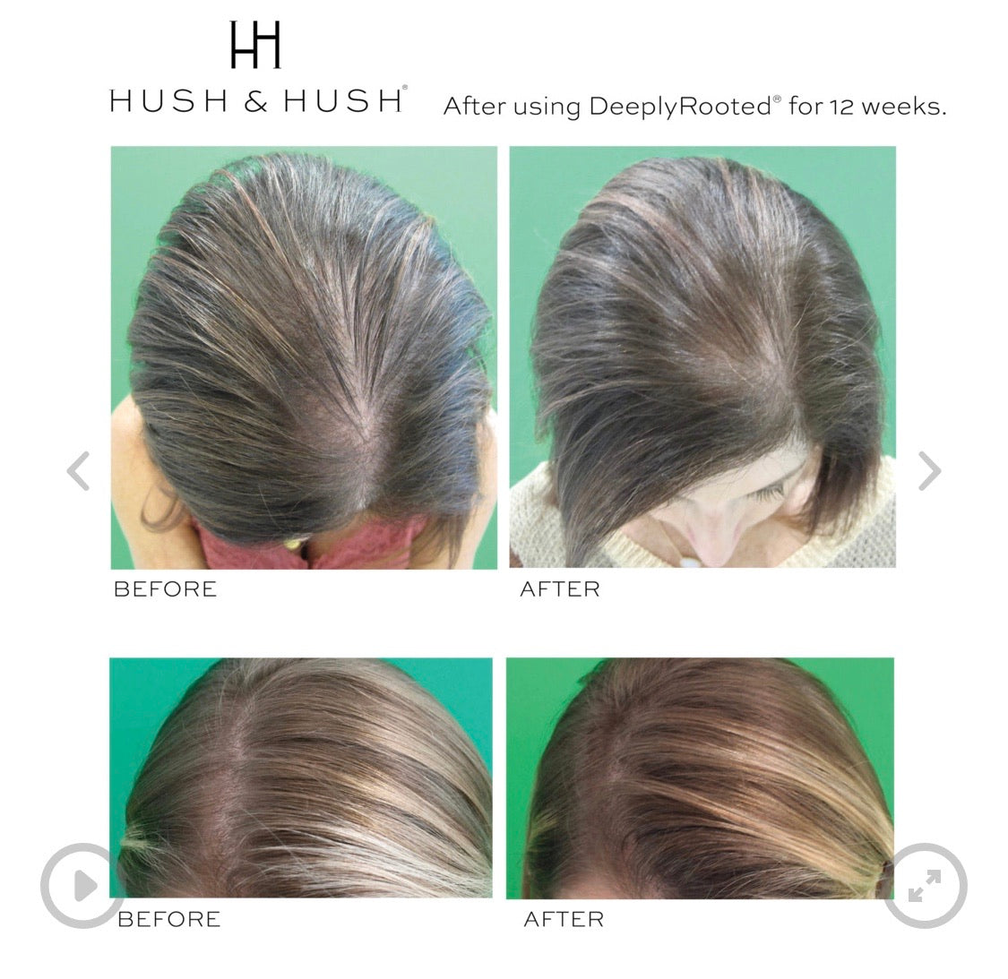 DeeplyRooted (Hair Health)